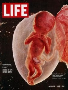 Life Magazine's “Drama of Life Before Birth” was Published