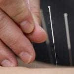 Study: Acupuncture found to Relieve Menstrual Pain for Up to a Year