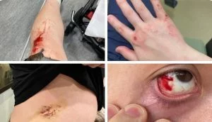 Antifa Terrorists Brutally Beat Brave Journalist Andy Ngo While He Was Reporting on Portland Riots