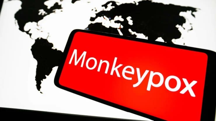 WHO Declares Monkeypox Outbreak a Global Health Emergency